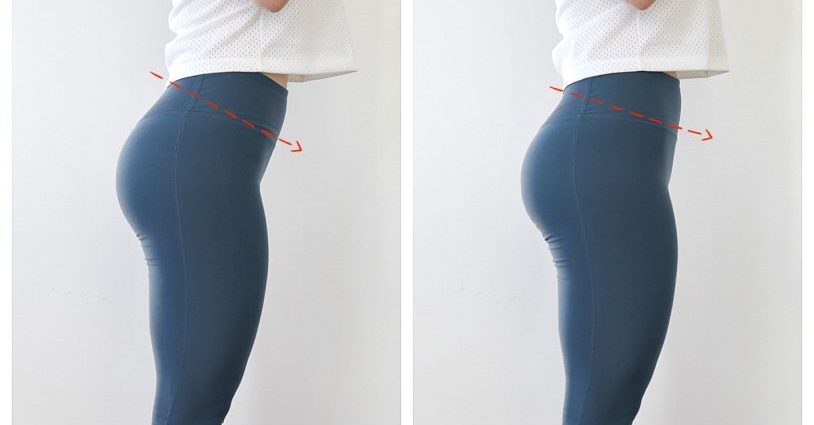anterior pelvic tilt compariosn before and after