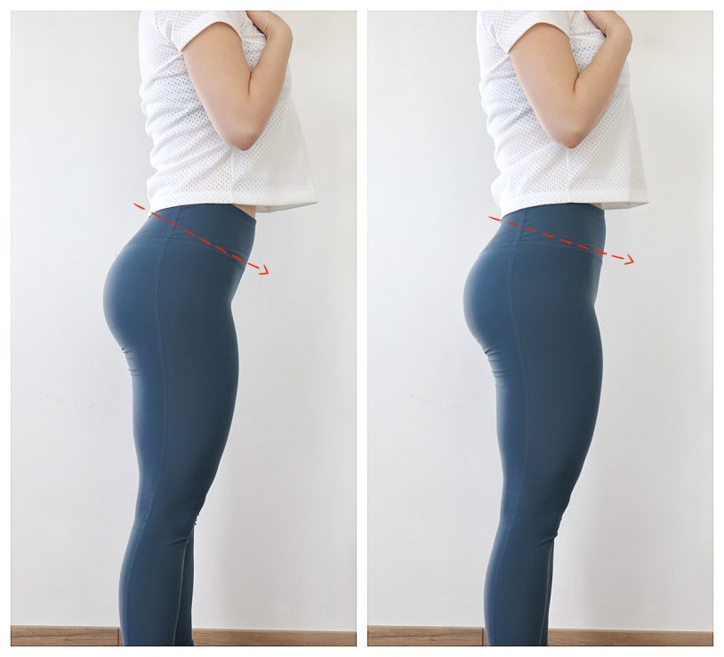 anterior pelvic tilt compariosn before and after
